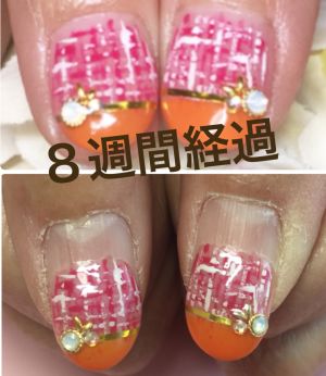 U-nail