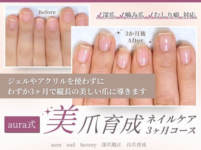 aura 深爪矯正 自爪育成 パラジェル登録サロン