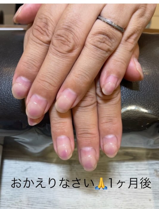 Key-nail