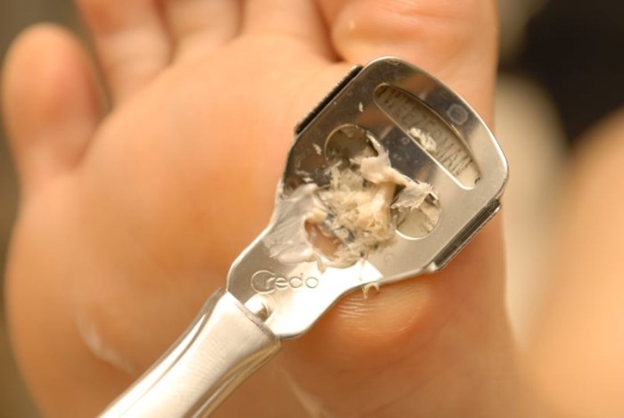 Nail & Foot J-ark