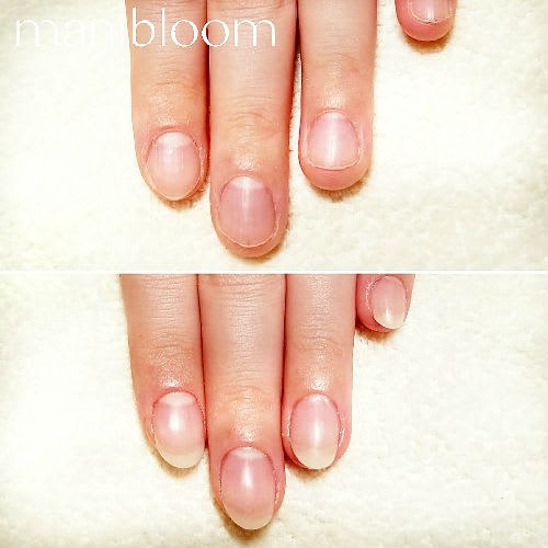 深爪矯正専門サロンmanibloom